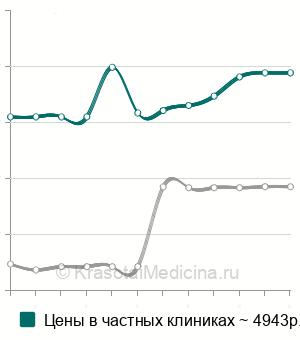Средняя стоимость КТ пазух носа ребенку в Москве