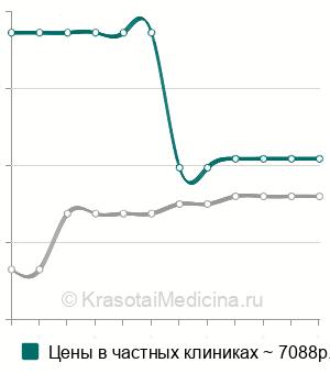 Средняя стоимость сцинтиграфии молочных желез в Москве