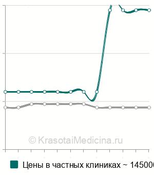 Средняя стоимость замены электрокардиостимулятора в Москве