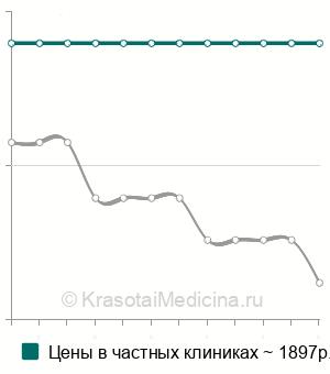 Средняя стоимость электронейрографии в Москве