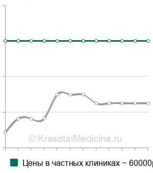 Средняя стоимость эмболизации бронхиальных артерий в Москве