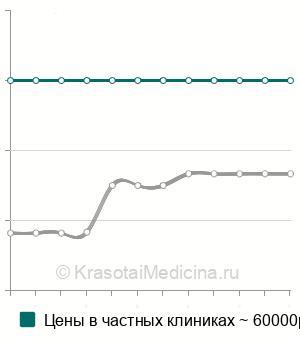 Средняя стоимость эмболизации ветвей легочной артерии в Москве