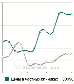 Средняя стоимость иссечение дивертикула пищевода в Москве