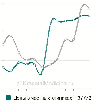 Средняя стоимость стентирования пищевода в Москве