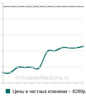 Средняя стоимость удаления инородного тела из верхнечелюстной пазухи в Москве