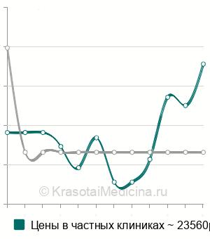 Средняя стоимость ПИКСИ (PICSI) в Москве