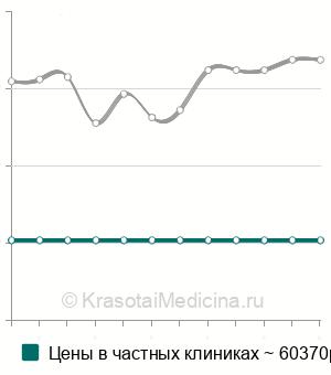 Средняя стоимость эмболизация варикозных вен пищевода и желудка в Москве
