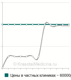 Средняя стоимость эмболизации желудочной артерии в Москве