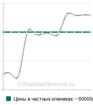 Средняя стоимость эмболизация желудочной артерии в Москве