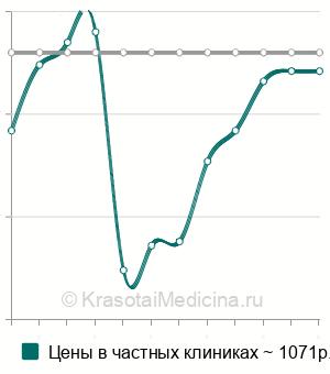 Средняя стоимость орошения влагалища озонированным раствором в Москве