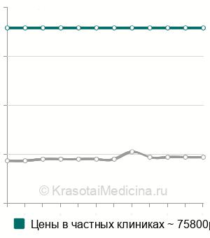 Средняя стоимость гепатикоеюностомии в Москве