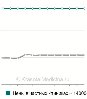 Средняя стоимость резекции кишки при кишечной непроходимости в Москве