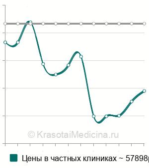 Средняя стоимость интравитреальное введение Луцентис в Москве