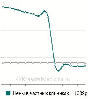 Средняя стоимость биохимия крови (оценка функции почек) в Москве