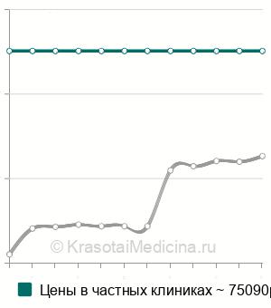 Средняя стоимость энуклеация опухоли печени в Москве