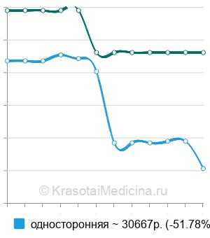 Средняя стоимость паховой лимфаденэктомии в Москве