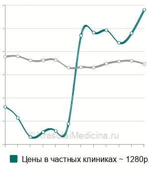 Средняя стоимость наложение повязки (суспензория) на мошонку в Москве