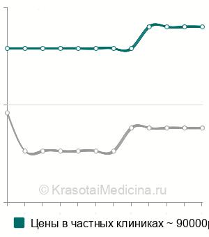 Средняя цена на оссикулопластику в Москве
