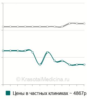 Средняя стоимость МРТ кости в Москве