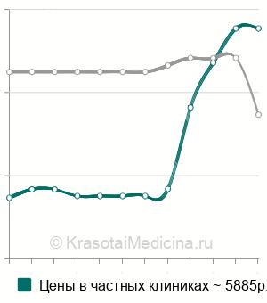 Средняя стоимость МРТ кости в Москве