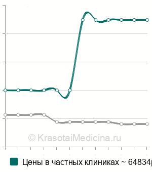 Средняя стоимость артропластика локтевого сустава в Москве