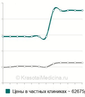 Средняя стоимость артропластика коленного сустава в Москве