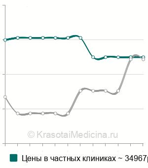 Средняя стоимость удаление хондромных тел коленного сустава в Москве
