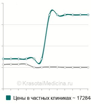Средняя стоимость остеосинтеза переднего и заднего тазового полукольца в Москве