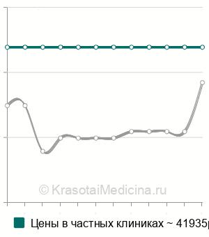 Средняя стоимость артропластика плечевого сустава в Москве