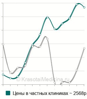 Средняя стоимость восковое моделирование зуба в Москве
