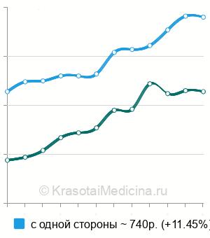 Средняя стоимость пневмомассаж барабанной перепонки в Москве