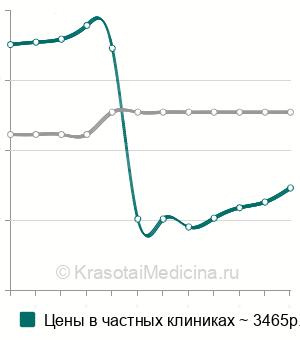 Средняя стоимость тимпанопункции в Москве