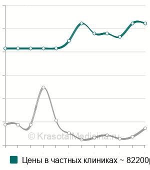 Средняя стоимость декомпрессия нервных стволов в Москве
