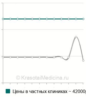 Средняя стоимость аутопластики нервных стволов в Москве