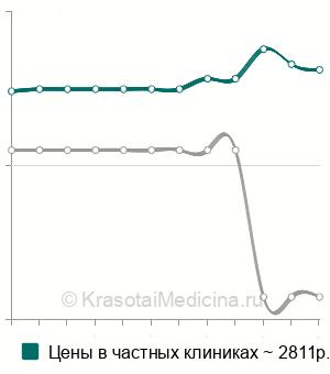 Средняя цена на криотерапию хронического фарингита в Москве