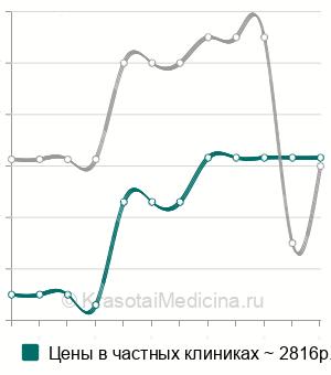 Средняя стоимость криотерапия хронического фарингита в Москве