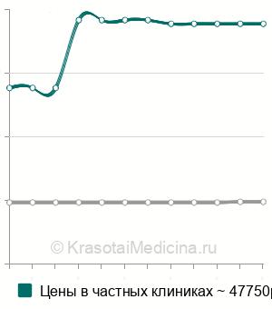 Средняя стоимость ФДТ при раке кожи в Москве