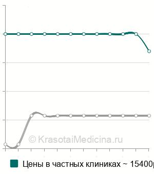 Средняя стоимость лазеркоагуляции субретинальной неоваскулярной мембраны в Москве