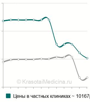 Средняя стоимость криопексия сетчатки в Москве