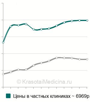 Средняя стоимость удаление камня слюнной железы в Москве