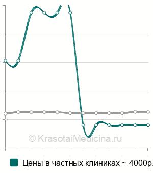 Средняя стоимость динамической сцинтиграфии гепатобилиарной системы в Москве