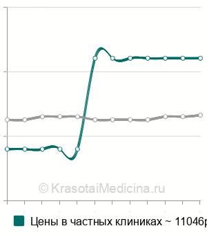 Средняя стоимость динамическая сцинтиграфия гепатобилиарной системы в Москве