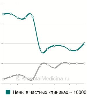Средняя стоимость трепанопункции лобной пазухи в Москве