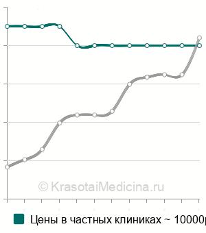 Средняя стоимость трепанопункция лобной пазухи в Москве