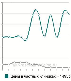 Средняя стоимость посев на уреаплазму с определением чувствительности в Москве