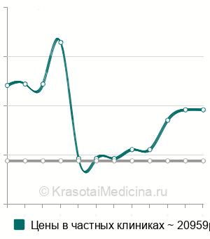 Средняя стоимость удаление инородного тела из матки в Москве