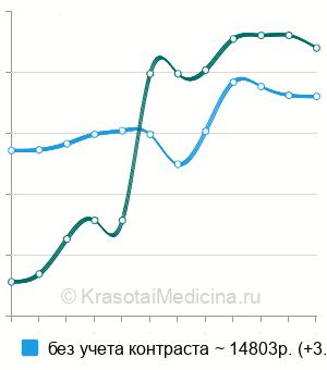 Средняя стоимость КТ-коронарография в Москве