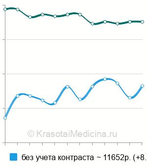 Средняя стоимость МРТ сердца в Москве