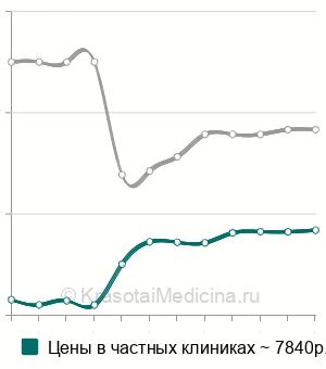 Средняя стоимость гидросонографии маточных труб в Москве