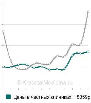 Средняя стоимость гидросонографии маточных труб в Москве